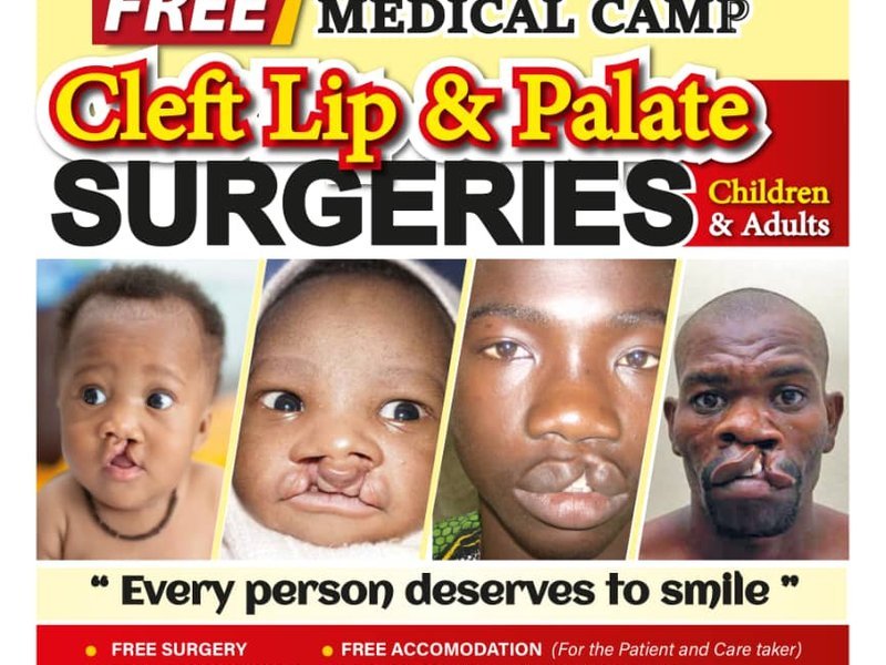 Cleft Lip Surgery Camp